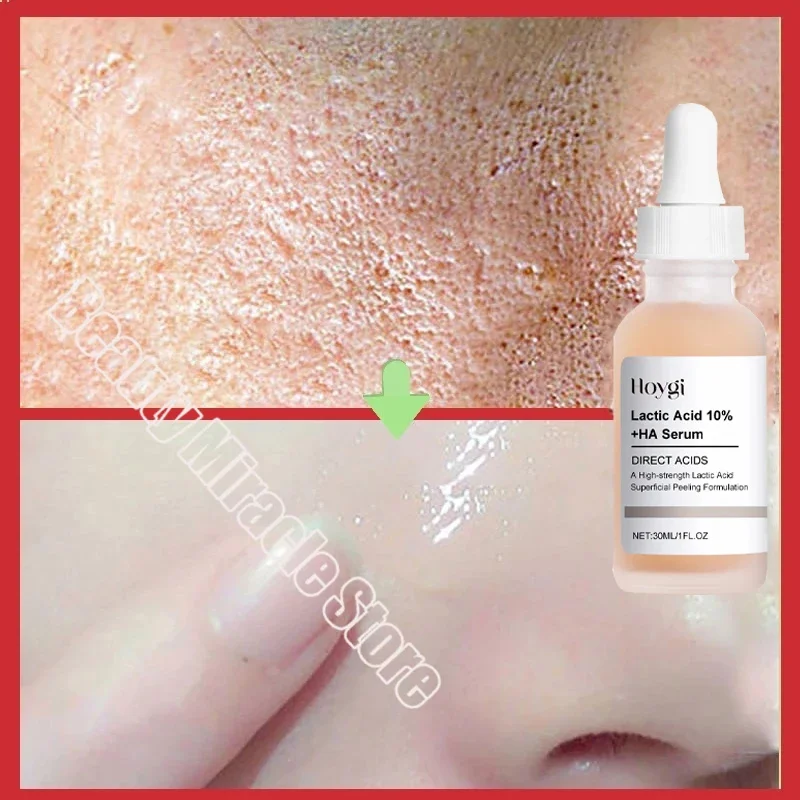 Remove Large Pores Serum Lactic Acid Facial Pore Shrinking Repairing Products Pore Minimizing Firming Smooth Korean Skin Care