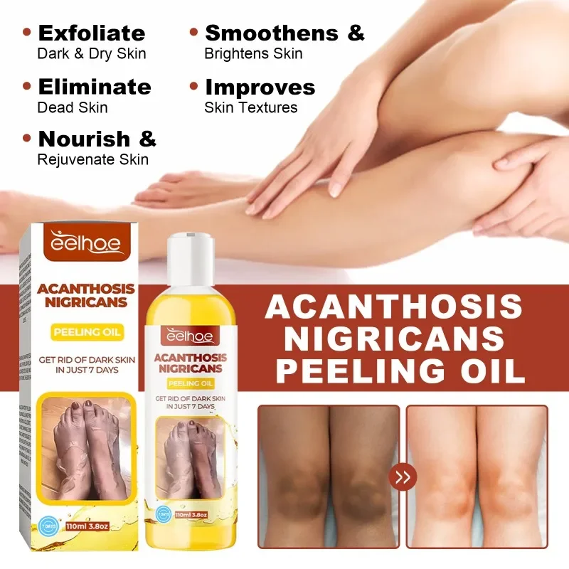 Acanthosis Nigricans Peeling oil Armpit elbow Knee joint whitening brighten skin remove Dark Melanin clean exfoliating body care