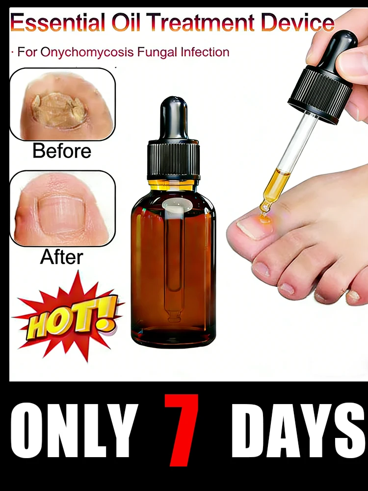 

2026 Toenail fungus treatment, ingrown toenail correction, nail discoloration, nail damage, foot care tools