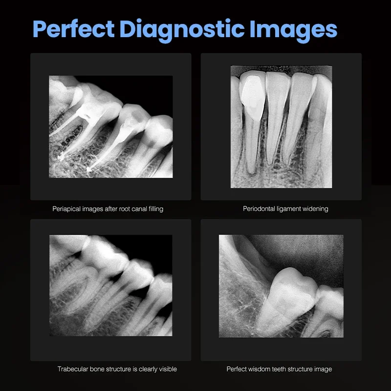 مستشعر RVG للأسنان الرقمي داخل الفم لعيادات الأسنان أو الأطباء البيطريين ، 0.8 و 1.5 مقاس كاشف الفوتون الرقمي وأجهزة استشعار تحديد المواقع