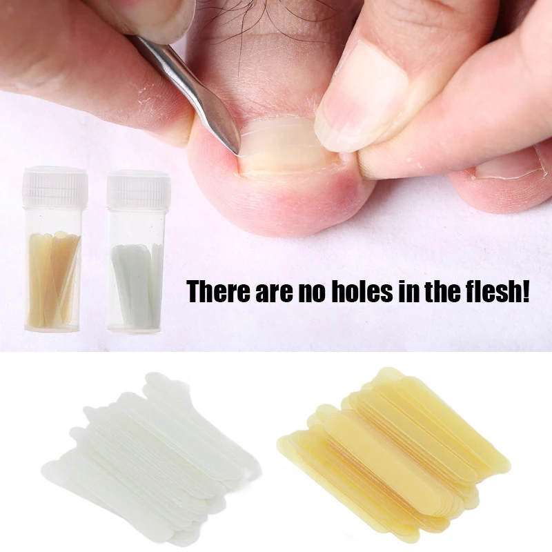 Ferramenta de correção do prego, etiqueta elástica, ferramentas do cuidado do pé, 50 pcs/box