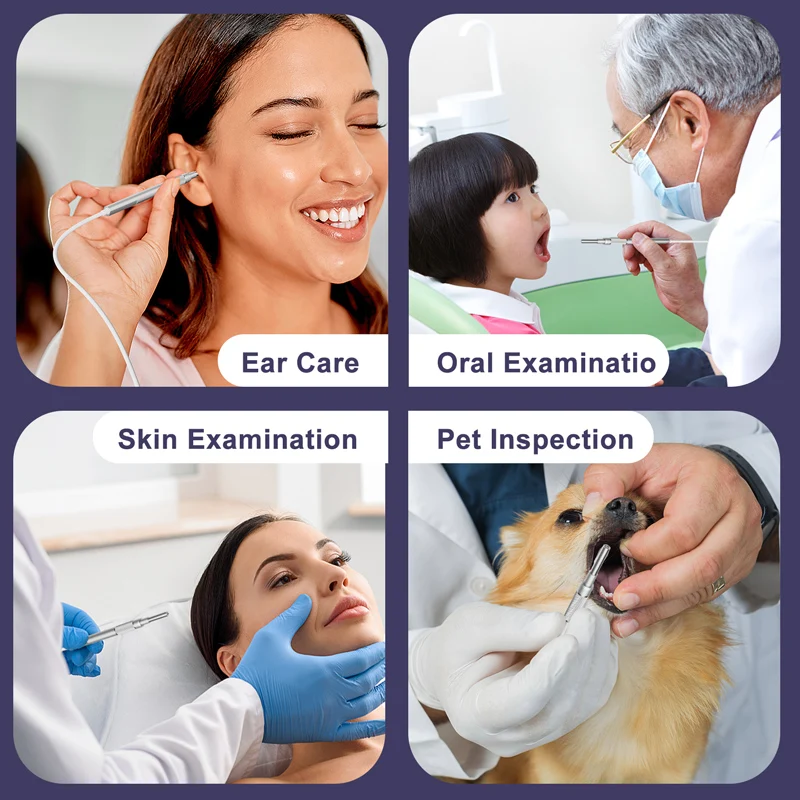 7'' IPS Screen Visual Ear Cleaning Camera HD1080P 3.9MM Ear Pick Digital Ear Spoon LEDs Ear Wax Removal Waterproof 32GB TF Card