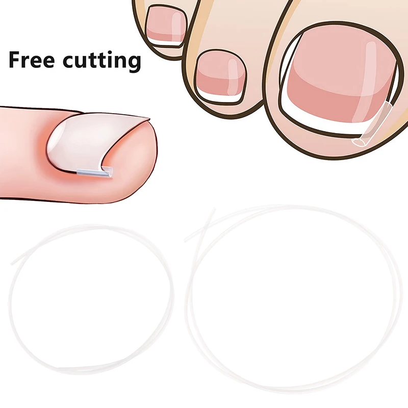 

Ingrown Toenail Correction Tool Ingrown Toe Nail Treatment Elastic Patch Sticker Straightening Clip Brace Pedicure Tool