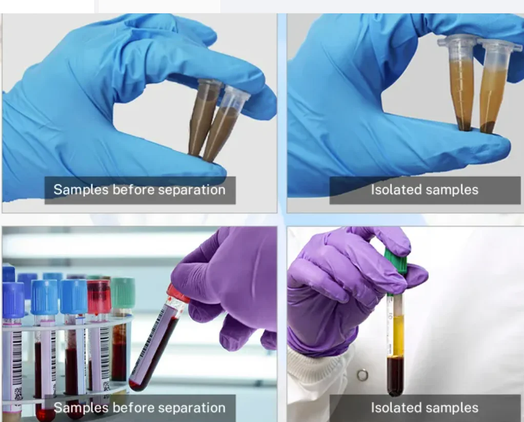 TGL-16M High-Speed Refrigerated Centrifuge 16000rpm Benchtop Lab Centrifuge 6×100ml Fixed Angle Rotor for Medical Research Labs