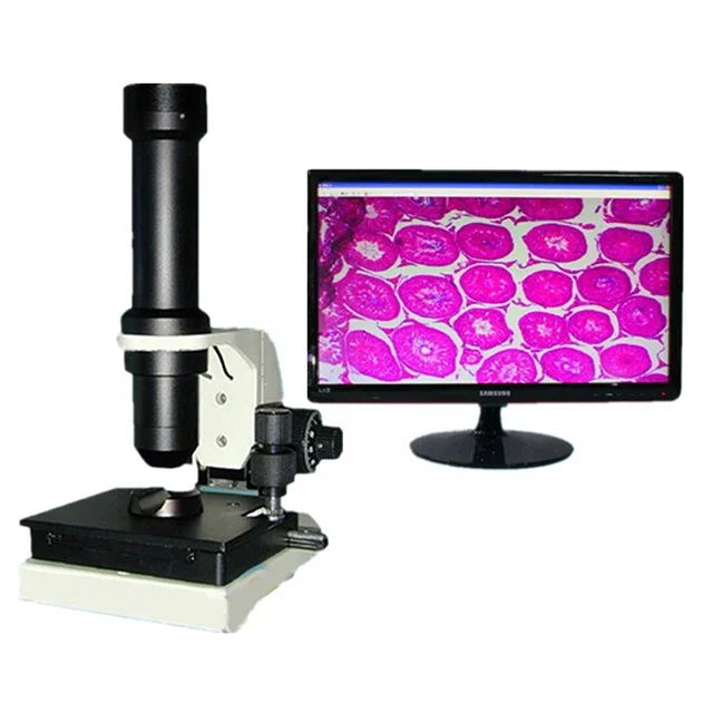 

Sperm Biological Microcirculation Capillary Microscope/darkfield Live Blood Analysis Microscope