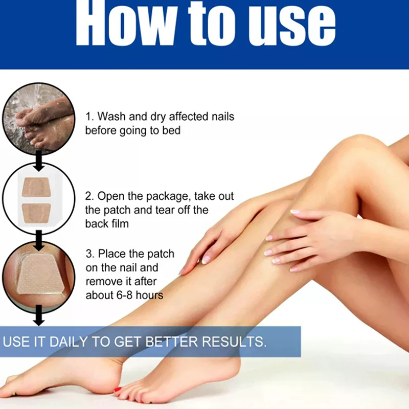 แผ่นแปะรักษาเชื้อราเล็บเท้า 60 ชิ้น แผ่นแปะซ่อมแซมเล็บแบบเหนียว แผ่นแปะแก้เล็บขบ แผ่นแปะดูแลเล็บเท้า รักษาเล็บขบ
