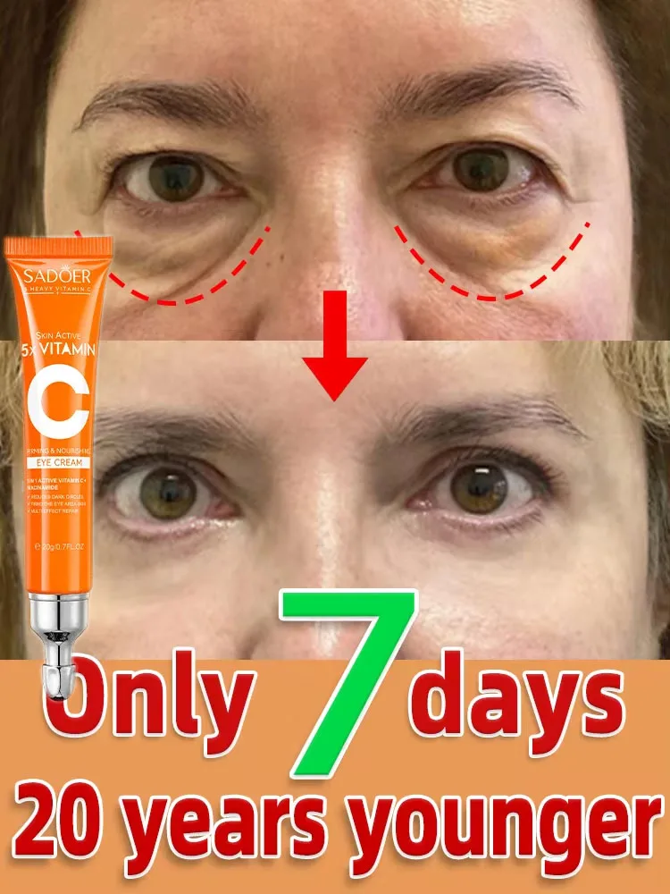 

Fast-acting Eye Cream Anti Wrinkle Firming Eye Bag Removal Anti Puffiness Dark Circles Eye Care Fade Fine Lines Brighten EyesGel