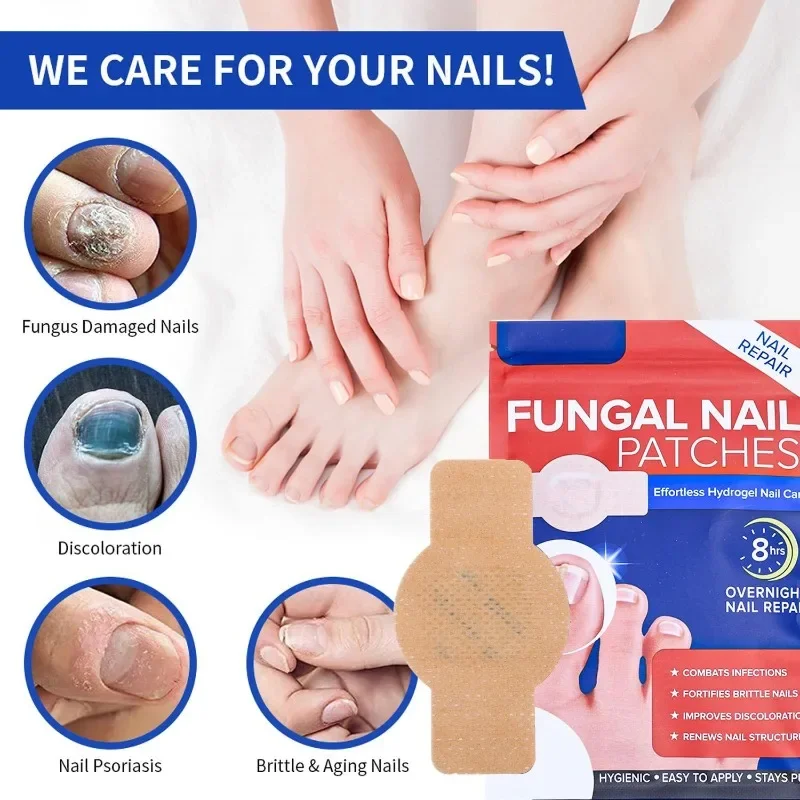 21/210Pcs Breathable Nail Protector Guard Breathable Finger Sleeve Toe Cap Cover Fingertip Protection Nail Fungus Care Tool