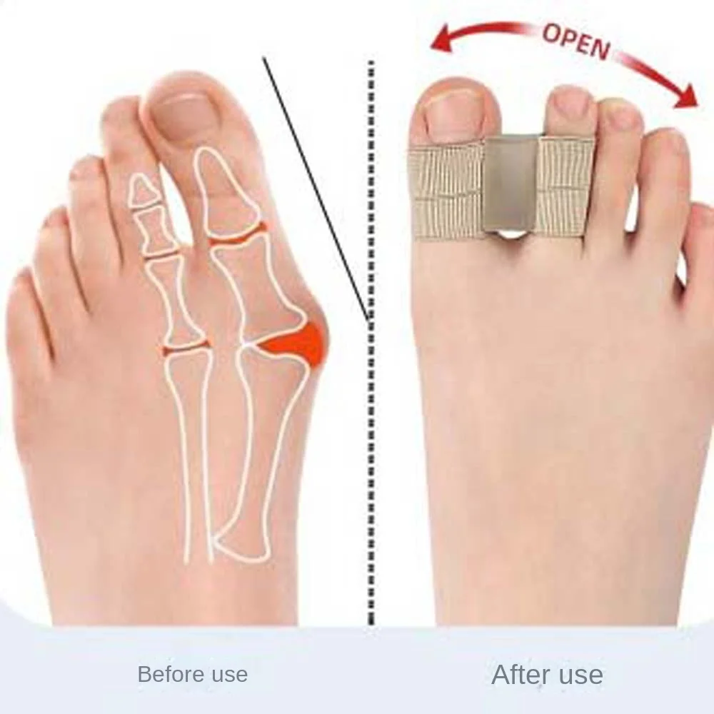 SEBS Toe Straightener Pedicure เครื่องมือ Foot Care Toe Separators Bunion Protector Toe Valgus Adjuster Toe Valgus Corrector Travel