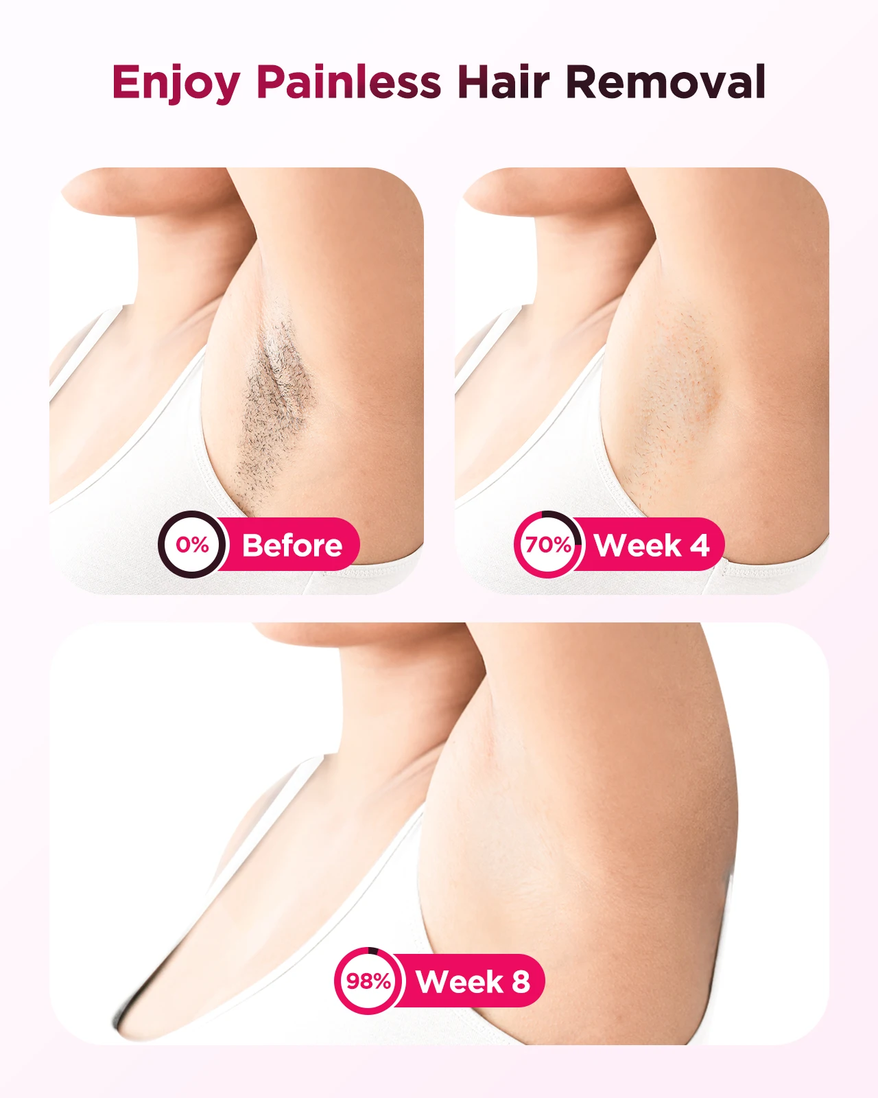 IPL alat Laser penghilang bulu, perangkat penghilang bulu Laser pendingin es 3 dalam 1 tanpa rasa sakit 16J fotoepilator permanen seluruh tubuh untuk pria dan wanita