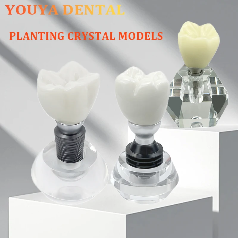 

1pcs Dental Single tooth Removable Crystal Implant Model Demonstration Tool Dental Teaching Research Model