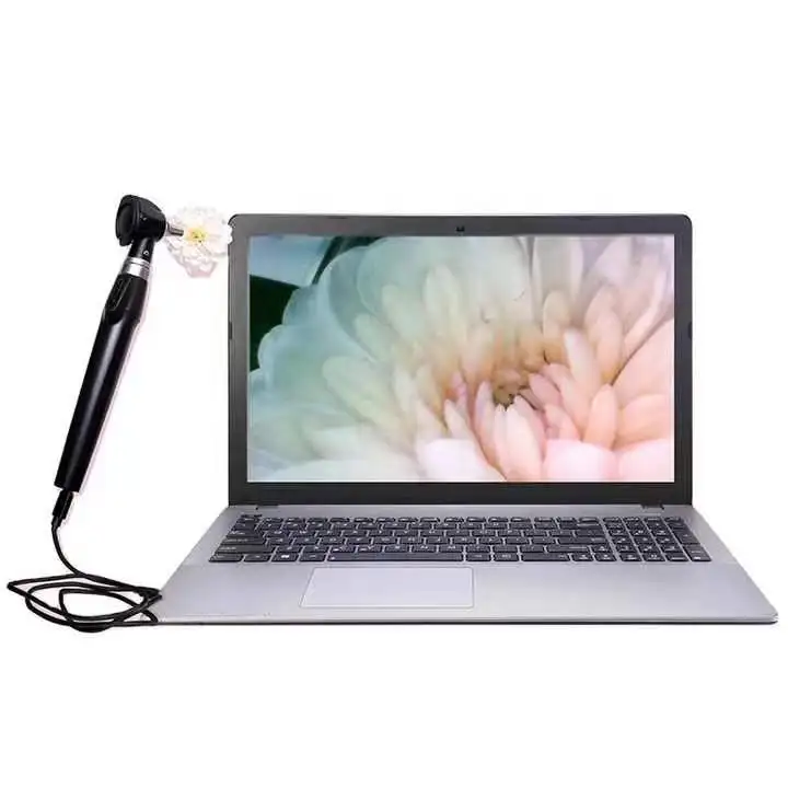 

Medical Durable and Portable Digital Video Otoscope with High Quality USB Ear Diagnostic Equipments