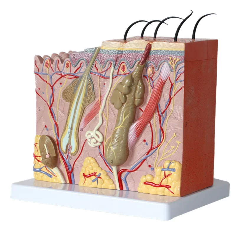 Enlarged Anatomical Model Of Human Skin Tissue Structure, Minimally Invasive Skin Beauty, And Skin Restructuring