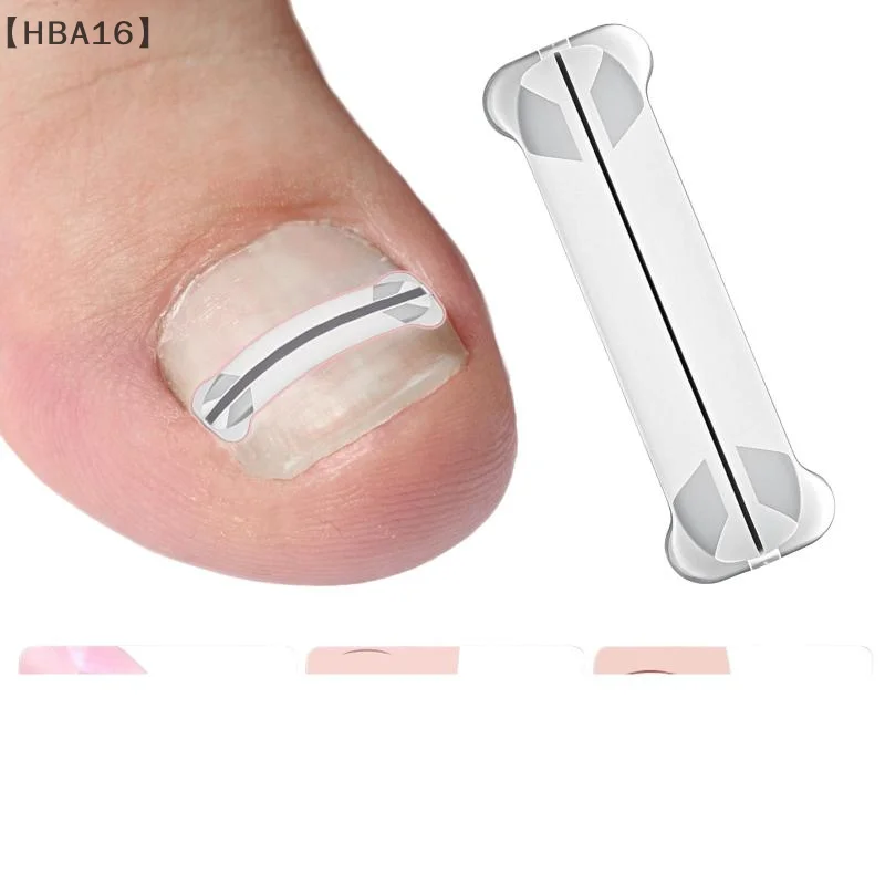 maveraHBA16 circulaire 13-20mm autocollants de Correction des ongles incarnés correcteur patchs Paronychia traitement récupérer correcteur pédicure aussi