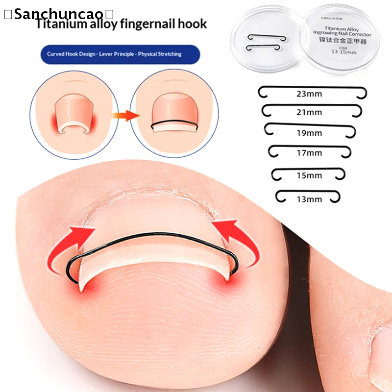 〔San〕2Pcs Ingrown T…