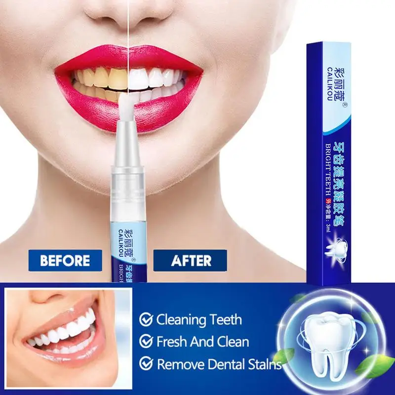 No Sensitivity Tooth Whiten Pen Professional Teeth Whitener And Stain Remover Travel-Friendly Effective Tooth Whiten Pens