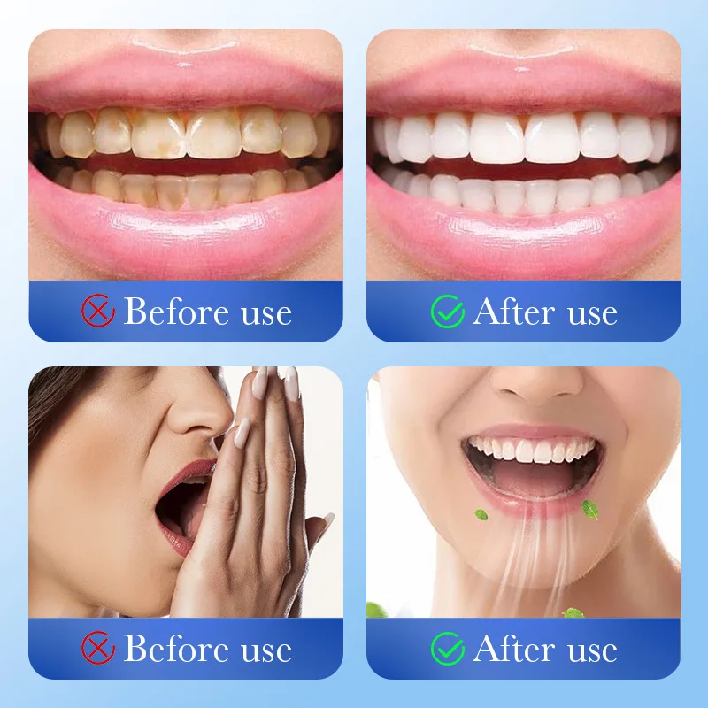 معجون أسنان بنكهة النعناع والزنجبيل معجون أسنان للعناية باللثة متعدد التأثير لتنظيف الجير وإصلاح حساسية الأسنان وتجويف الأسنان