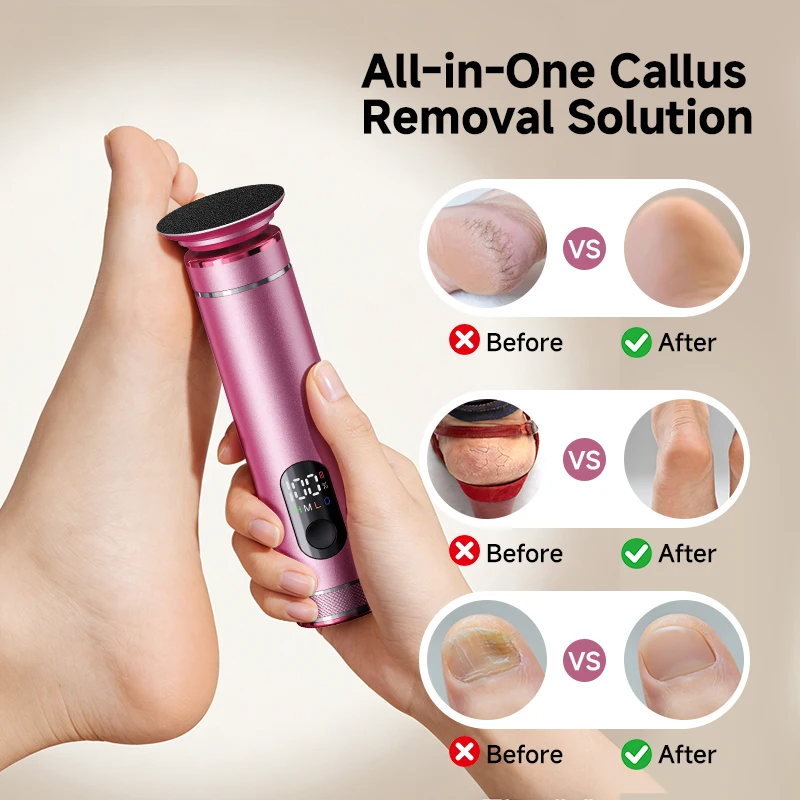 Electric Foot Callus Remover And Adjustable Foot File with 60pcs Sandpaper Discs Aluminum Alloy Nail Polisher with Gift Box 2 in