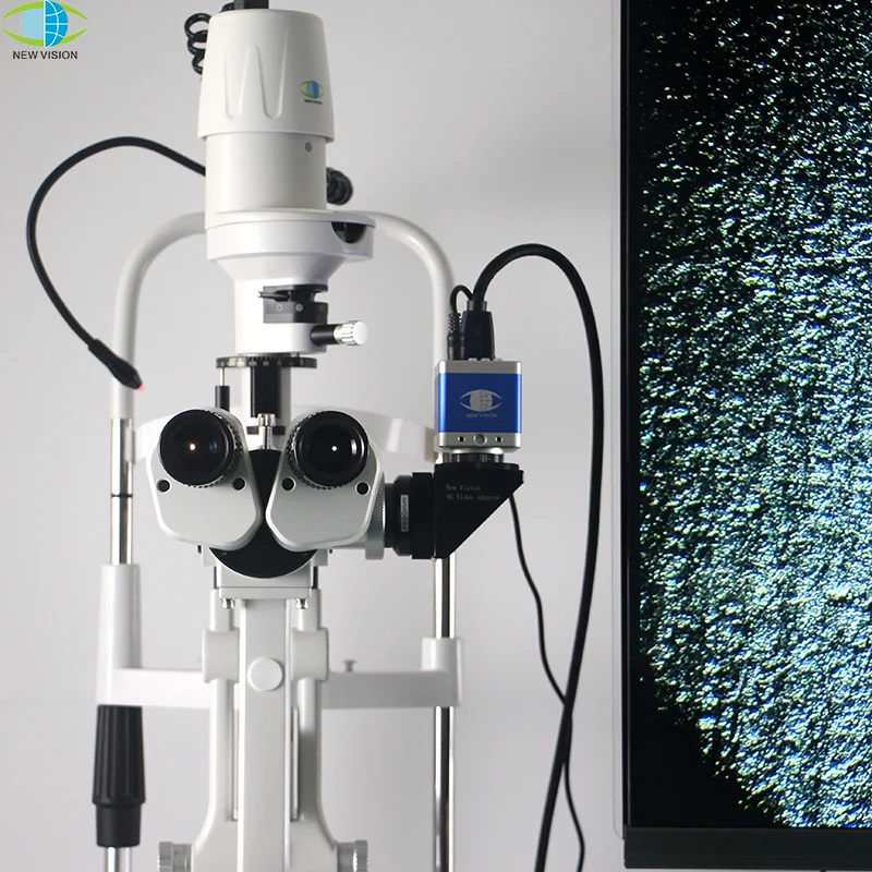 New Vision Surgical… - image