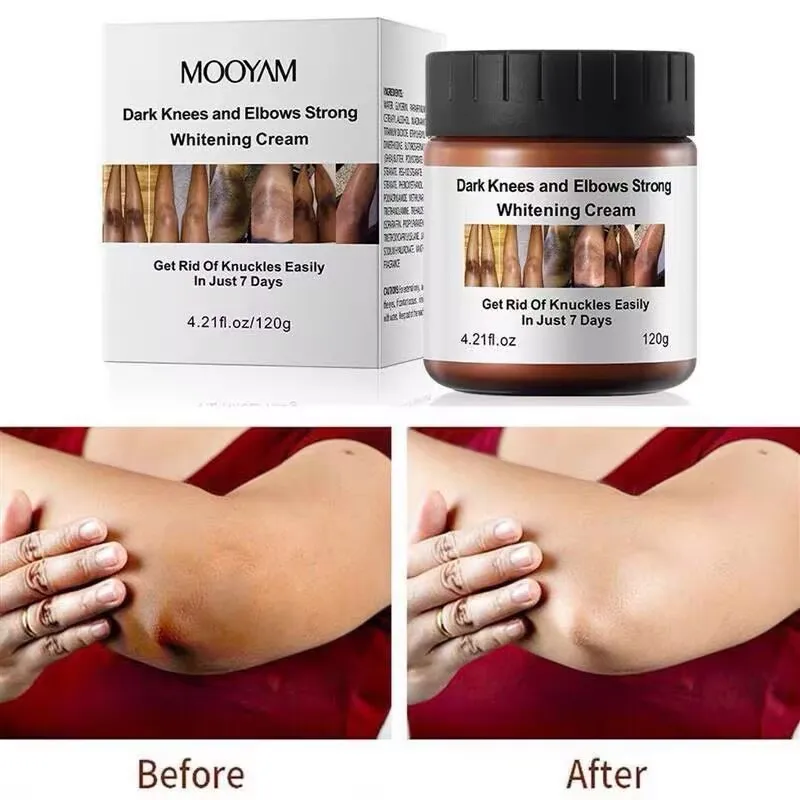 Dark knees and Elbows Strong Whitening Cream Joint Black Spot Melanin Cream120g