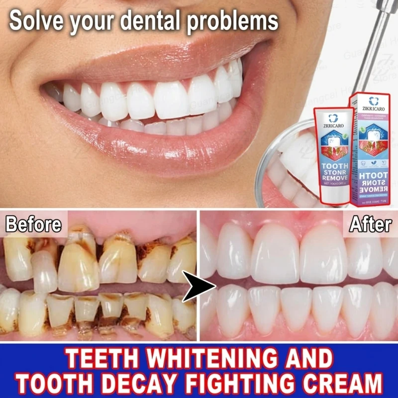 Remove Dental Calculus Hydroxyapatite Toothpaste – Effectively Combats Tartar, Deeply Removes Plaque, Promotes Enamel Re-Strengthening, Protects Gums, Relieves Swollen Gums & Bad Breath, Professional Oral Hygiene, Fresh Breath, Overall Care