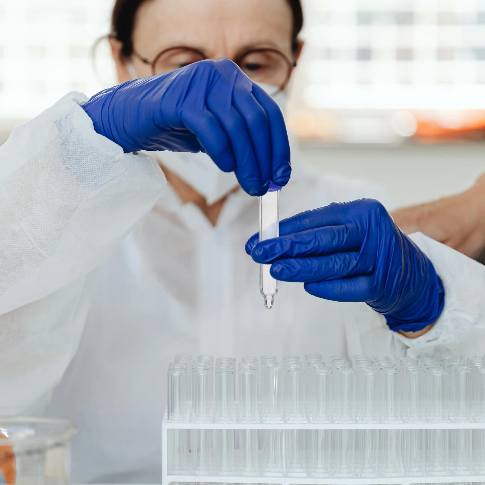 

200 Pcs Sediment Test Tube Plastic Urine Sample Storage Tubes Collection for Tests with Caps Cups