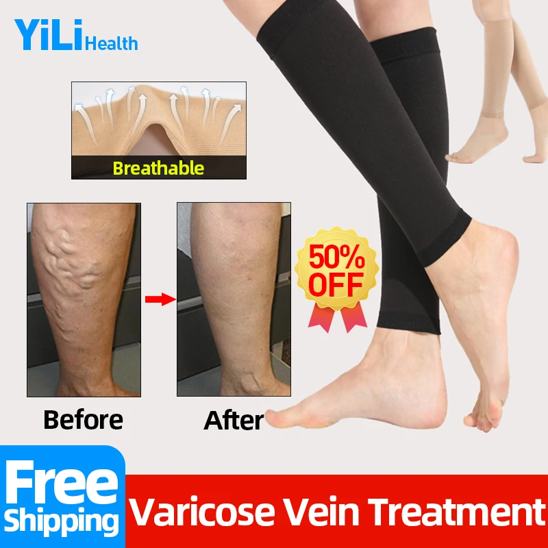 

Varicose Veins Tights Socks Prevent Vasculitis Inflammation Legs Calf Varicosity Phlebitis Compression Stockings