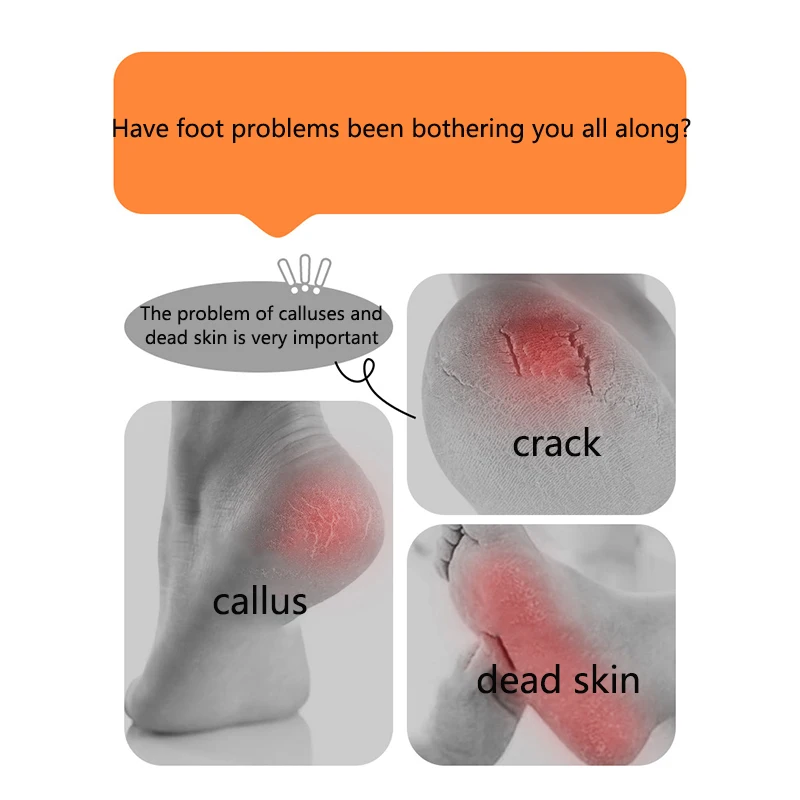 New Double Sided Feet Grinder Remove Dead Skin and Calluses Stainless Steel Hand Foot File Pedicure Exfoliating Foot Care Tool