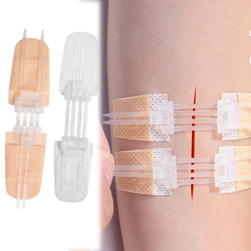 Zipper Band Aid Painless Wound Closure Patch Sutureless Sterile Dressing Reusable Adhesive Strips for Clinic Hospital Use