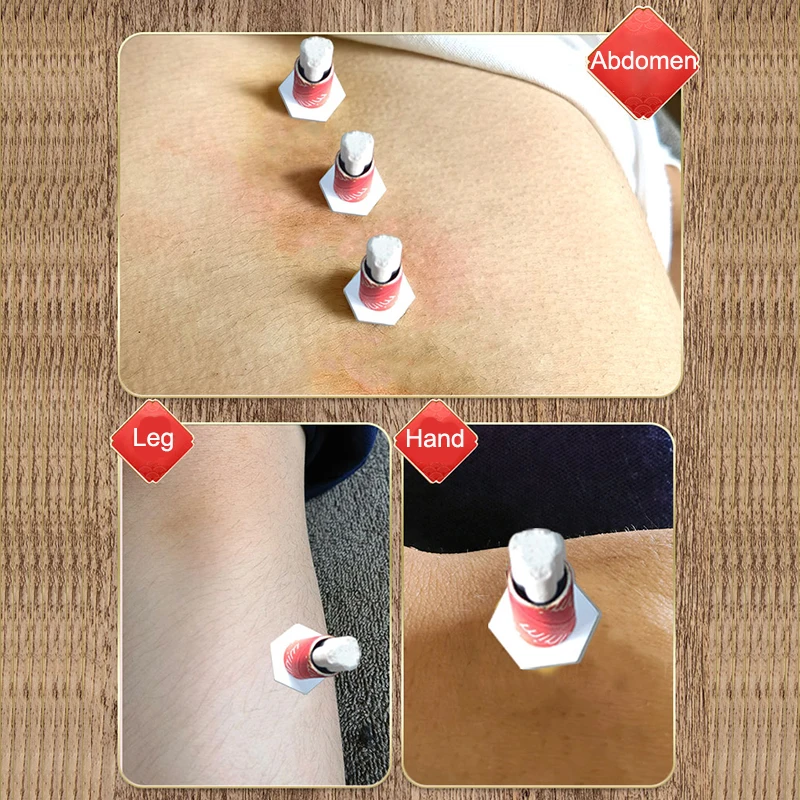 Terapia di digitopressione Mox - Herbal Wellness Patches recensione e prezzo