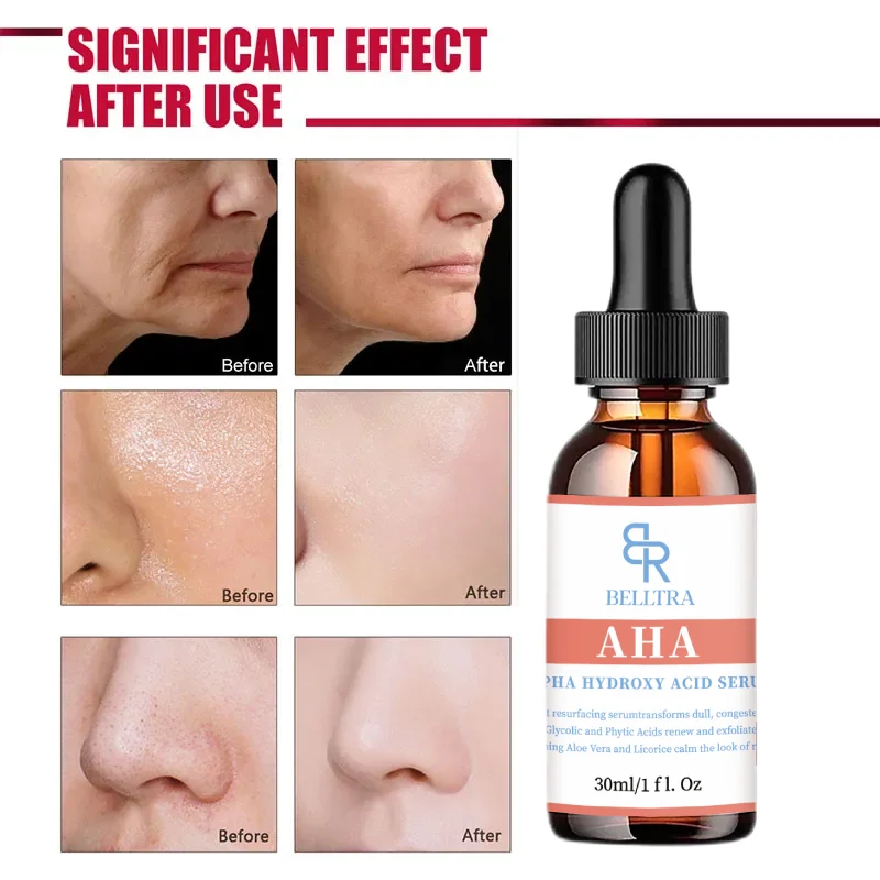 Moisture Alpha Hydroxy Acid Serum Regulates Acne And Reduces Mouth Closure Smooth Skin And Improve Roughness 30ml