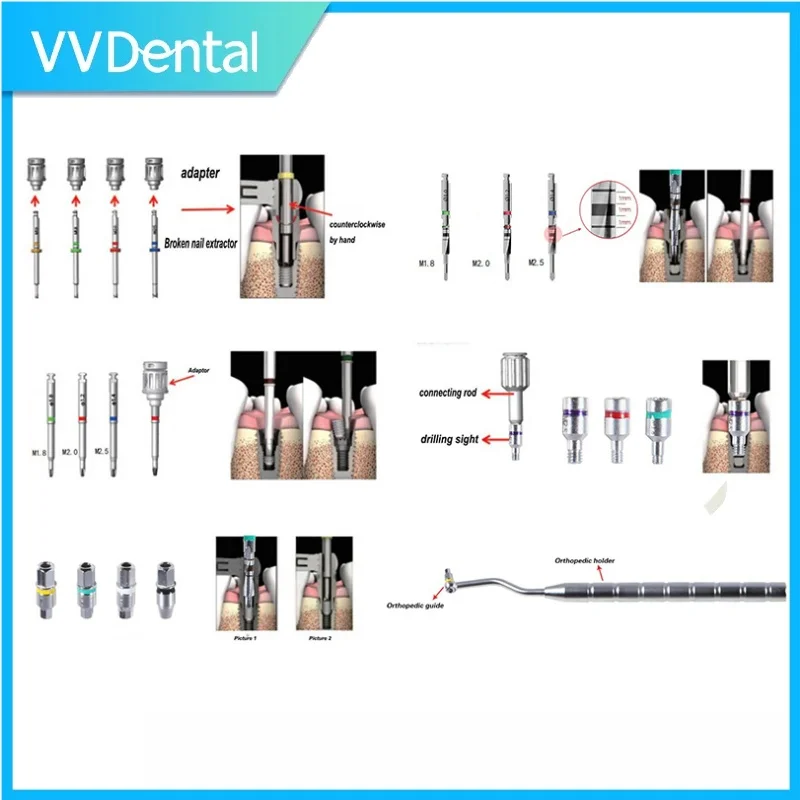VV Dendal Universal Implant And Broken Screw Extraction Kit Screw Remover Kit Broken Implantsrew Removal Dental Equipment