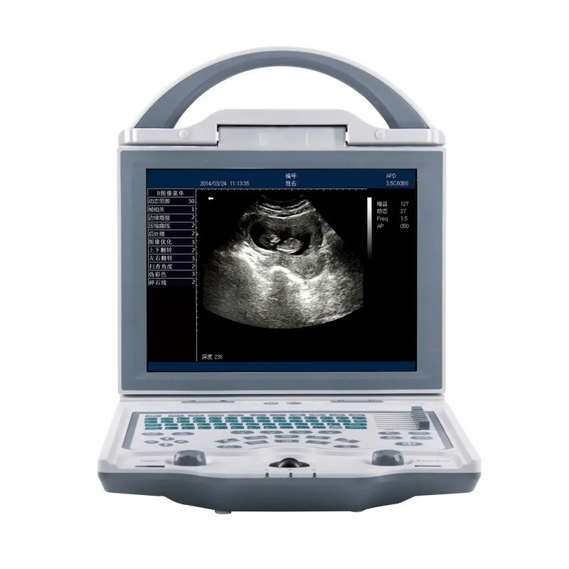 Color Doppler Ultrasound Machine Medical Diagnostic Imaging Equipment Portable 2d Ultrasound Scanner for Veterinary