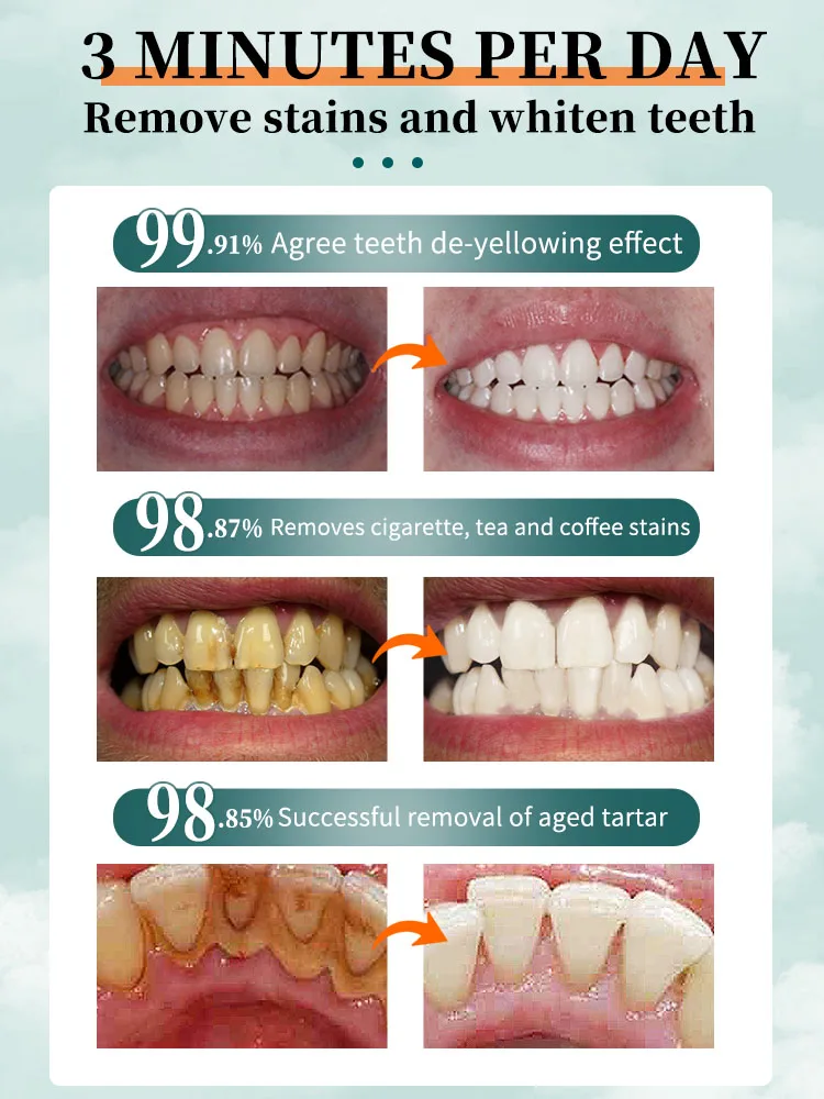 Dentifricio sbiancante viola rimuovi macchie riduce l\'ingiallimento cura per i denti gengive alito fresco denti schiarenti