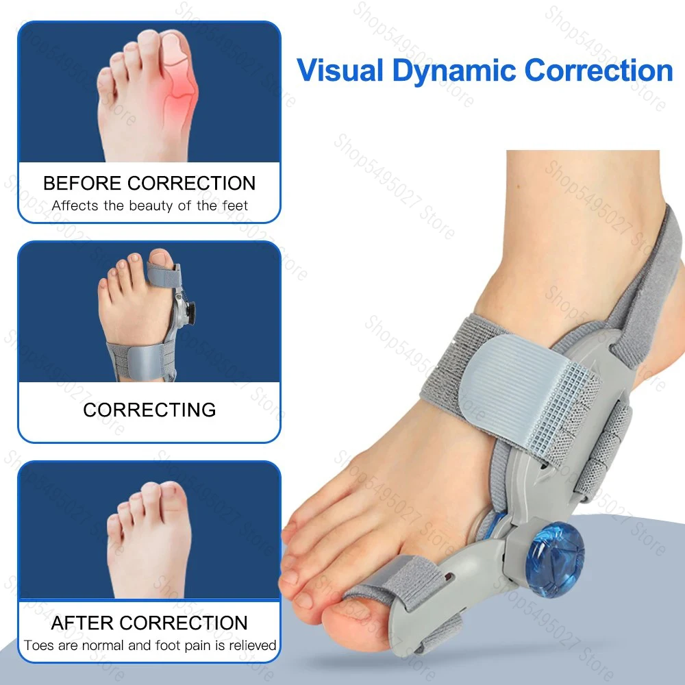 Bunion 교정기 조절식 무지외반증 엄지 발가락 교정기 회전식 발가락 교정기 조정 가능한 발가락 교정