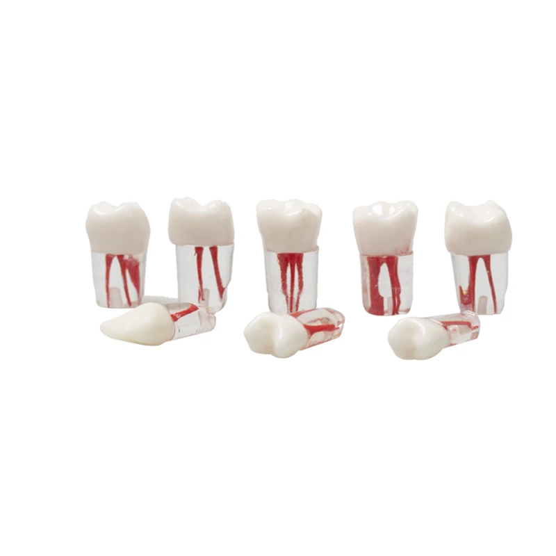 5PCS Dental Model Root Canal Obstruction Practice Dental Pulp Resin Tooth Research Dental Training Model Dental Products