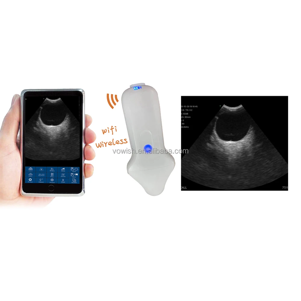 2023 new machine optical equipments wireless C Probe ophthalmic ultrasonic wireless ophthalmic B scan