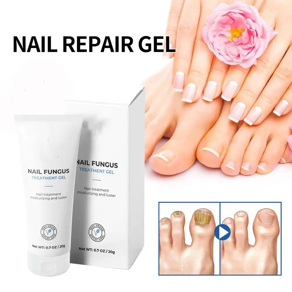 Nagel reparatur Nagel gel verbessert Barriere funktion feuchtigkeit spendendes Nagel behandlungs gel erfrischend leicht zu absorbieren des Nagel pflege gel