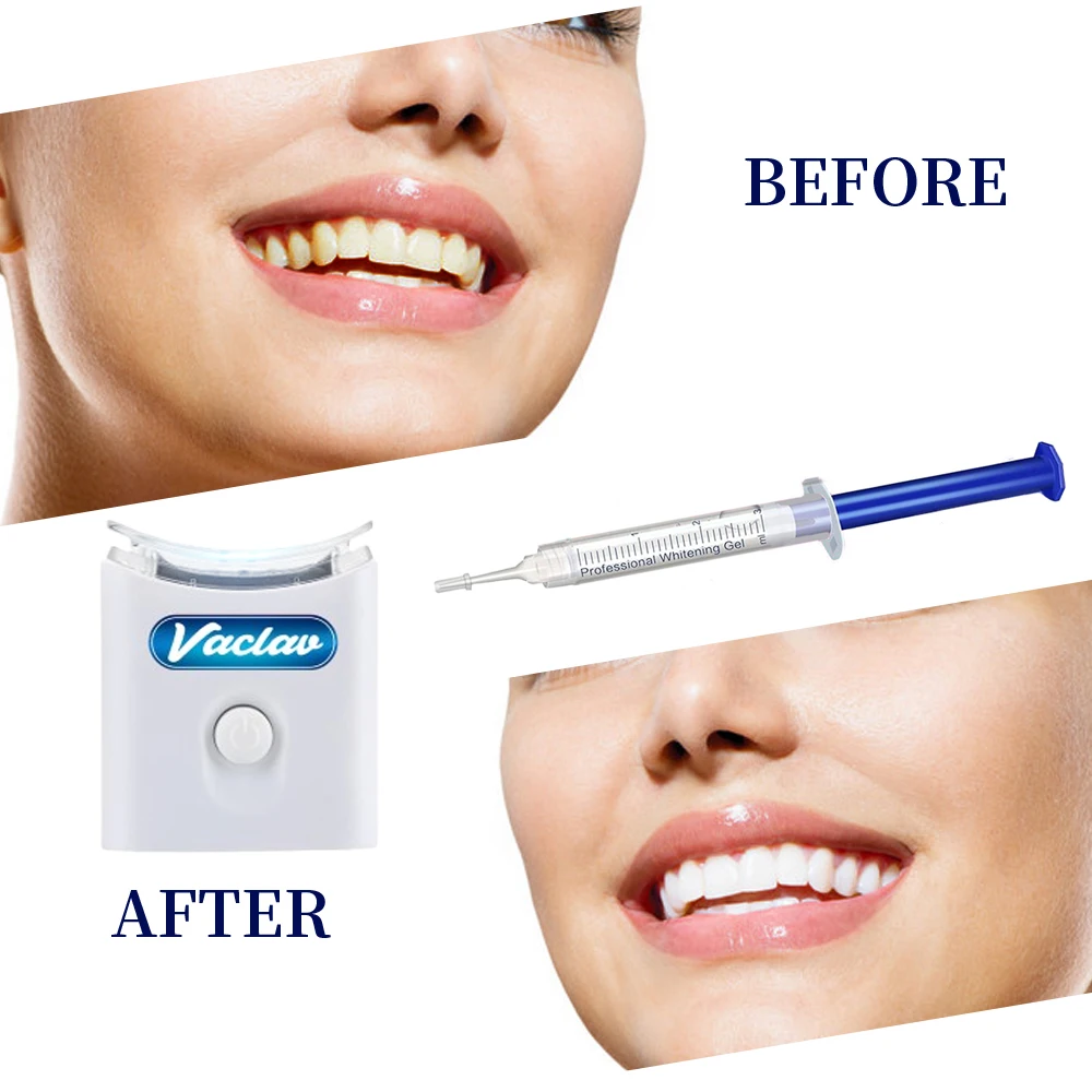 Thumbnail 4 - #64 Latest Teeth Whiteners Offers