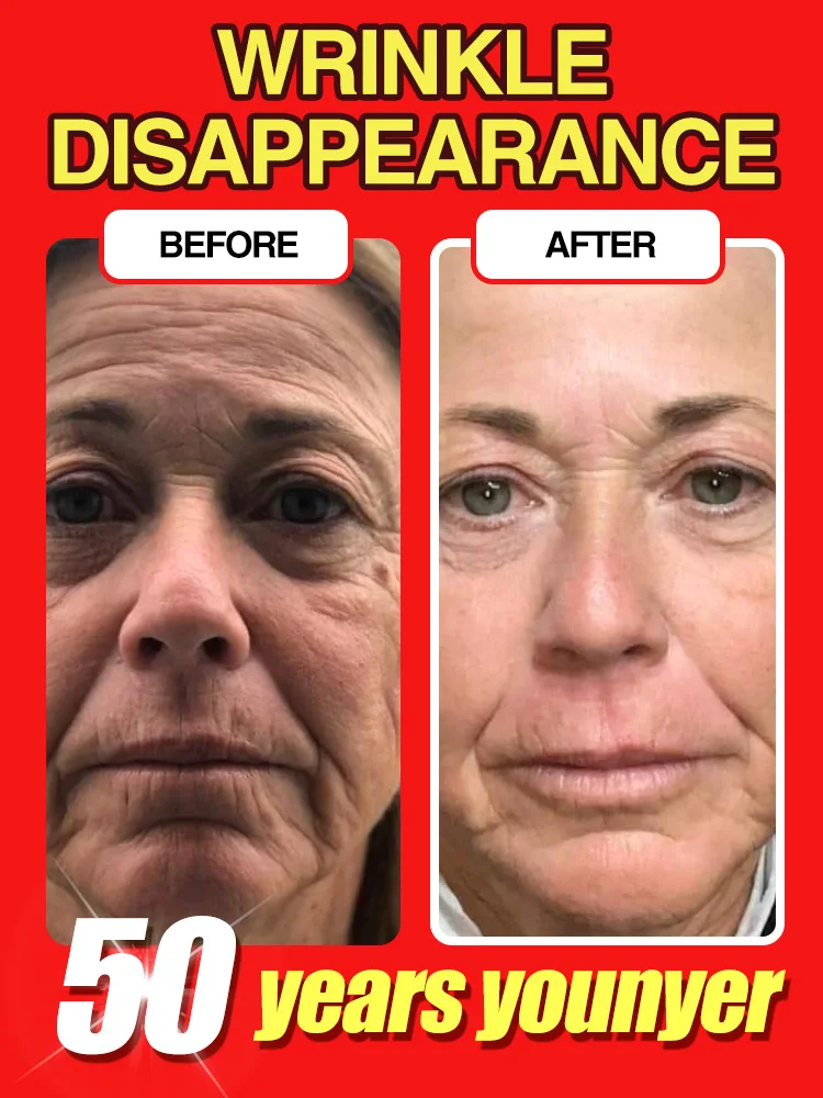 

Erase Wrinkles in Just 7 Days