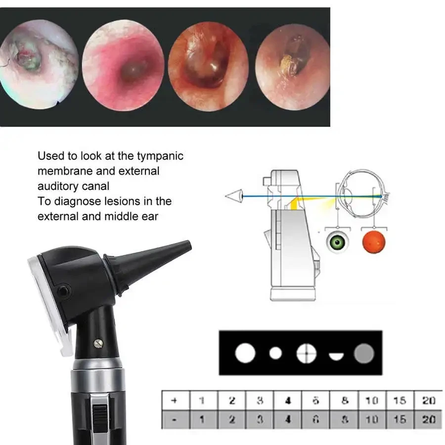 Professional ENT Diagnostic Portable Medical Endoscope Opthalmoscope LED Ear Otoscopio Direct Fiber Otoscope Ophthalmoscope