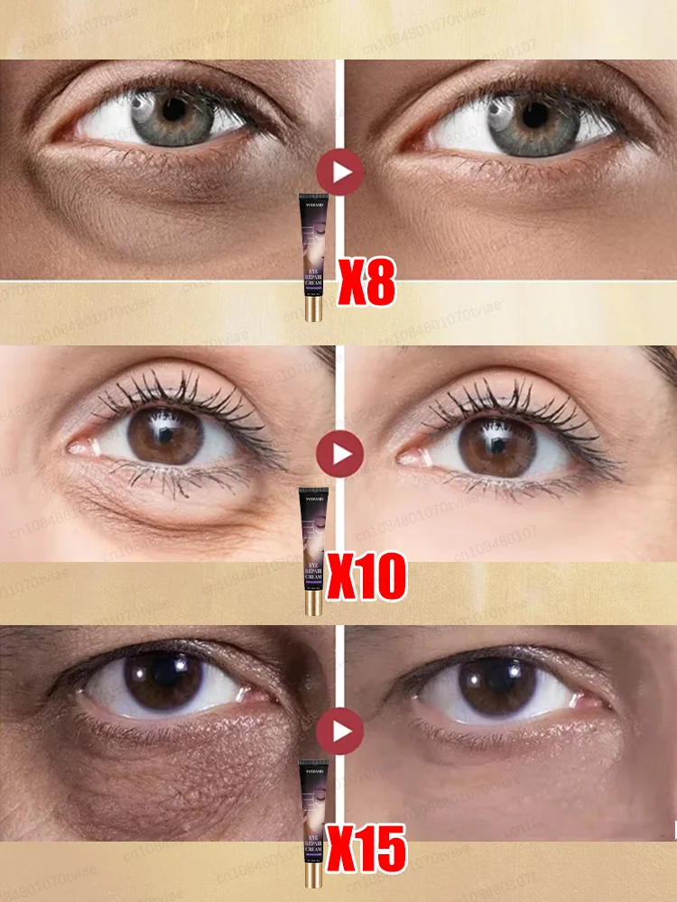 Crème contour des yeux pour éliminer rapidement les poches et les cernes