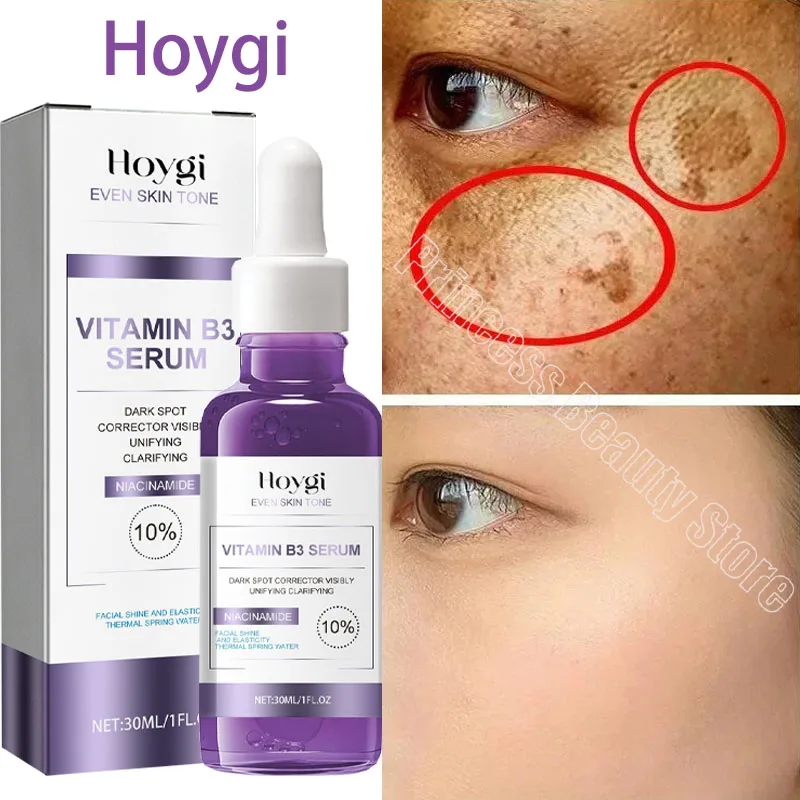 Donkere Vlekken Verwijderaar Whitening Serum Gezicht Sproet Melanine Corrigeert Anti Pigmentatie Helderder Schoonheid Koreaanse Dag Nacht Huidverzorging