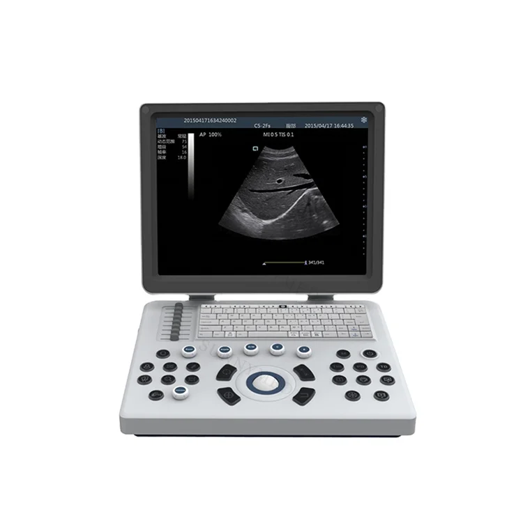 SYA-6Q Full Digital Black and White Ultrasound Machine full-digital 15 inch BW ultrasound diagnostic system