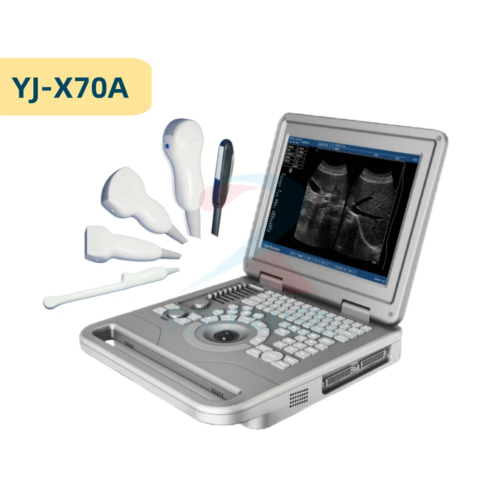 

Laptop Ultrasonic diagnostic System Portable Ultrasound Scanner Medical Ultrasound Instruments Ultrasound Machine Echography