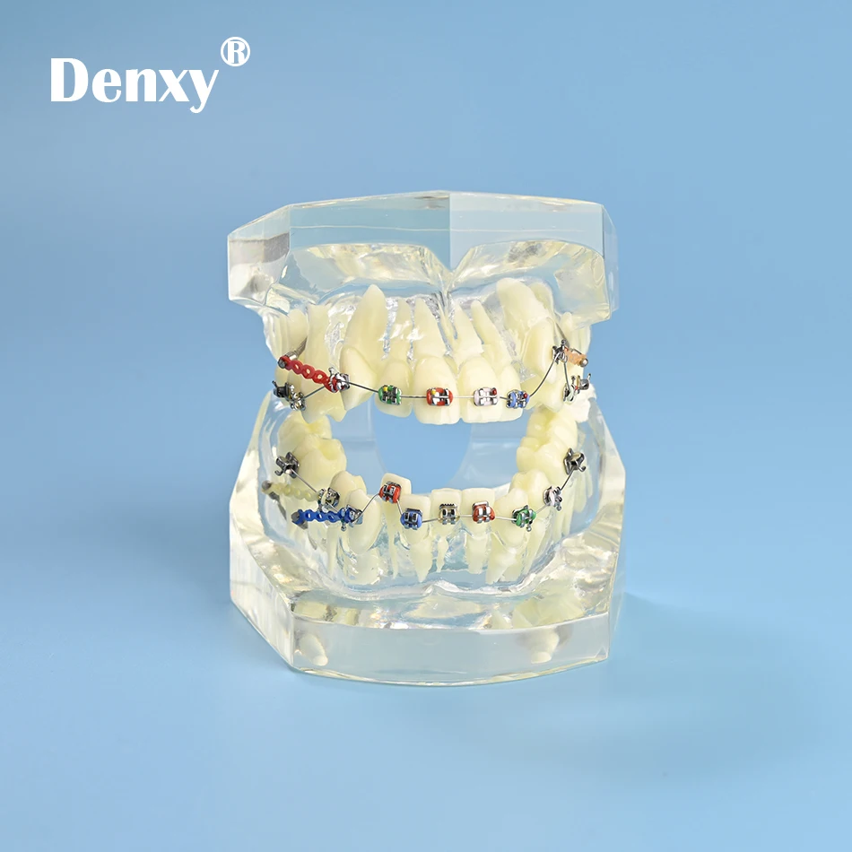 1 Stück Transparentes Zahnmedizinisches Lehrmodell für Zahnärzte, Endodontie-Zahnmodell mit orthodontischem Metallbracket und farbigen Brackets – Detail 7