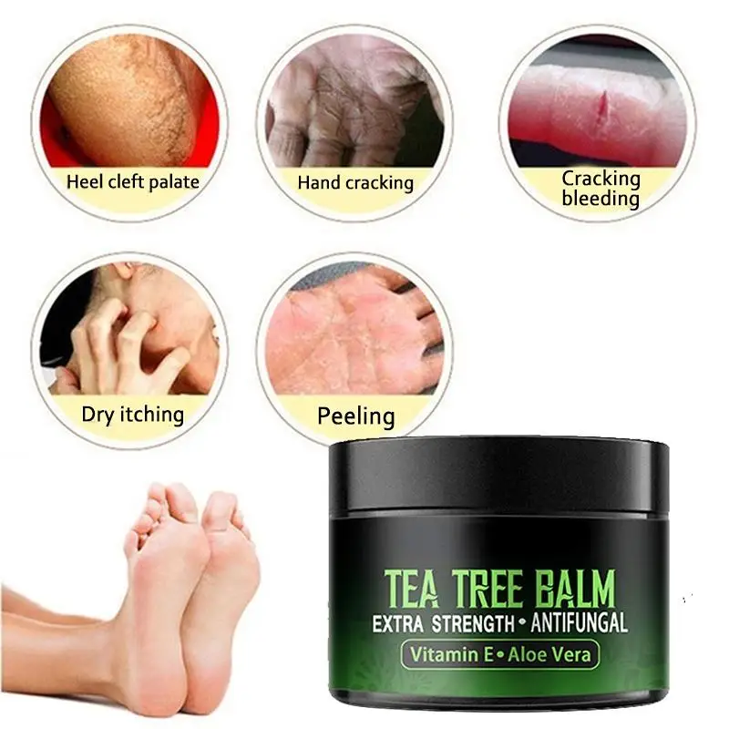 Anti-Drying Crack Foot Cream Heel Cracked Repair Cream Removal Dead Skin Hand Feet Care Hand and Foot Skin Care