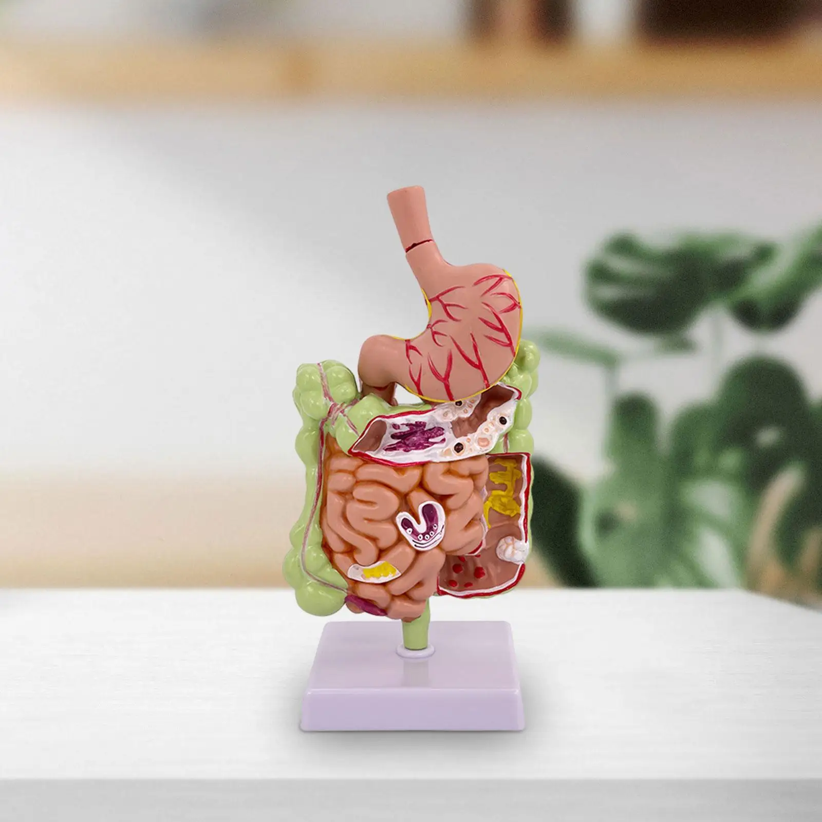 Human Stomach Anatomy Model PVC Pathological Digestive System Model for Study Display Education Office Classroom Demonstration