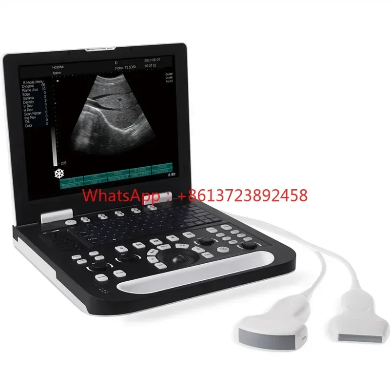 

15 Inch Portable Notebook USG Ultrasound Scanner Machine