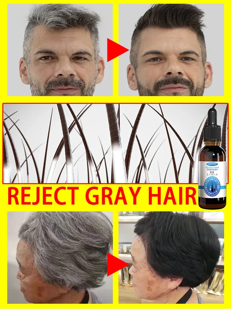 Suero para el tratamiento del cabello gris, blanco a negro, Color Natural, reparación, productos nutritivos, cuidado anticaída del cabello, hombres y mujeres